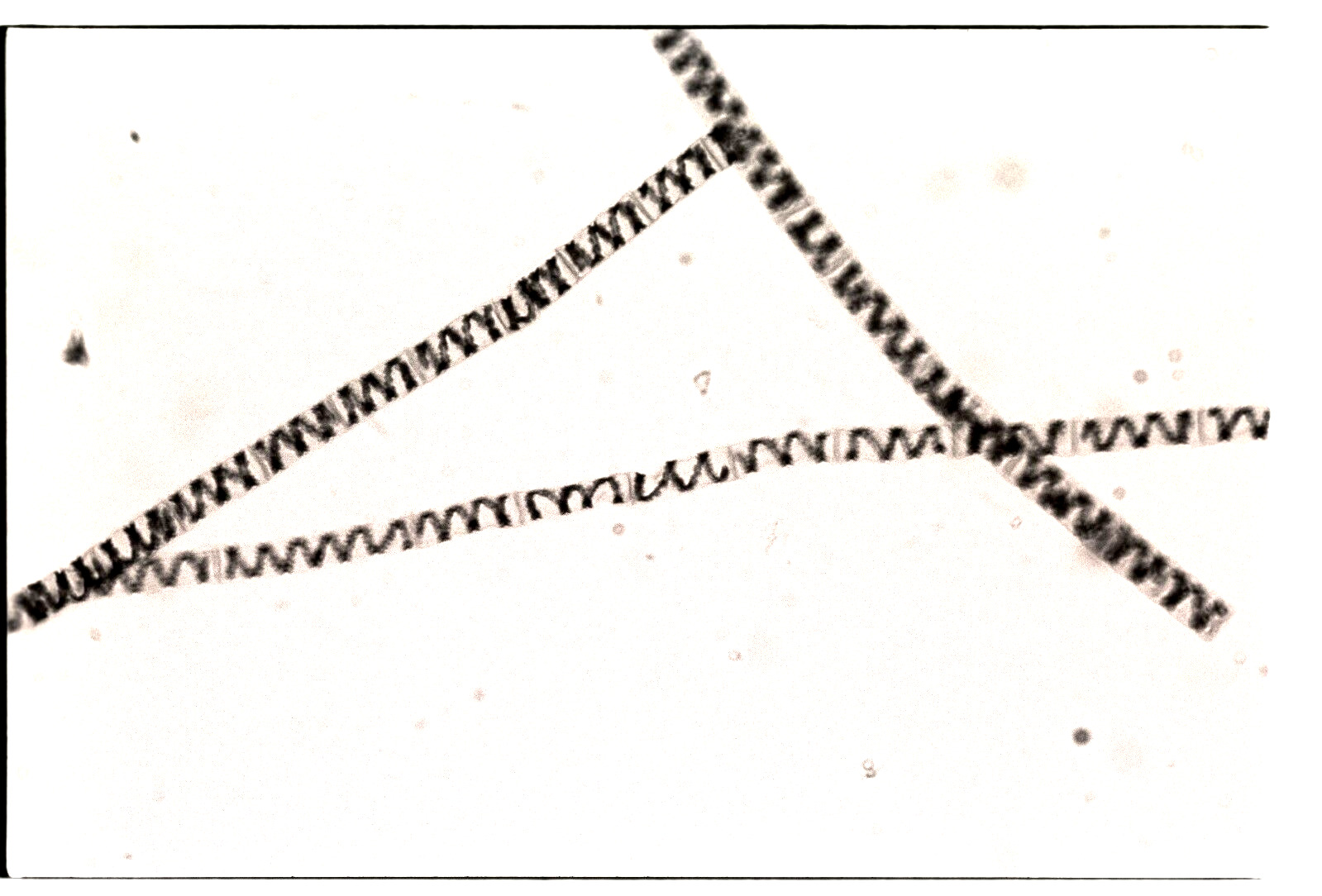 Spirogyra Micrograph Original 35 mm B&W Negative