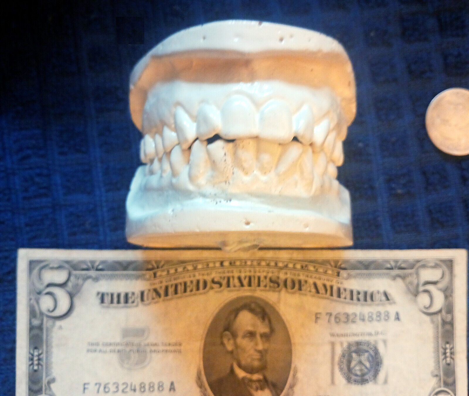 RARE Vintage Genuine HUMAN Tooth Upper & Lower Anatomical Dental Mold Casting